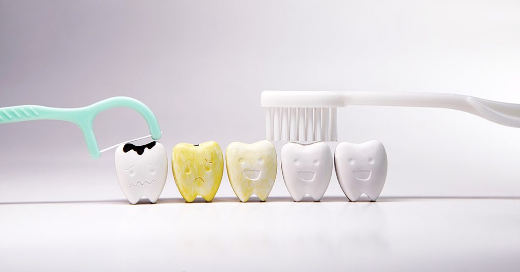 تغير لون الأسنان وتصبغات الاسنان اسبابها وعلاج تغير لون الاسنان