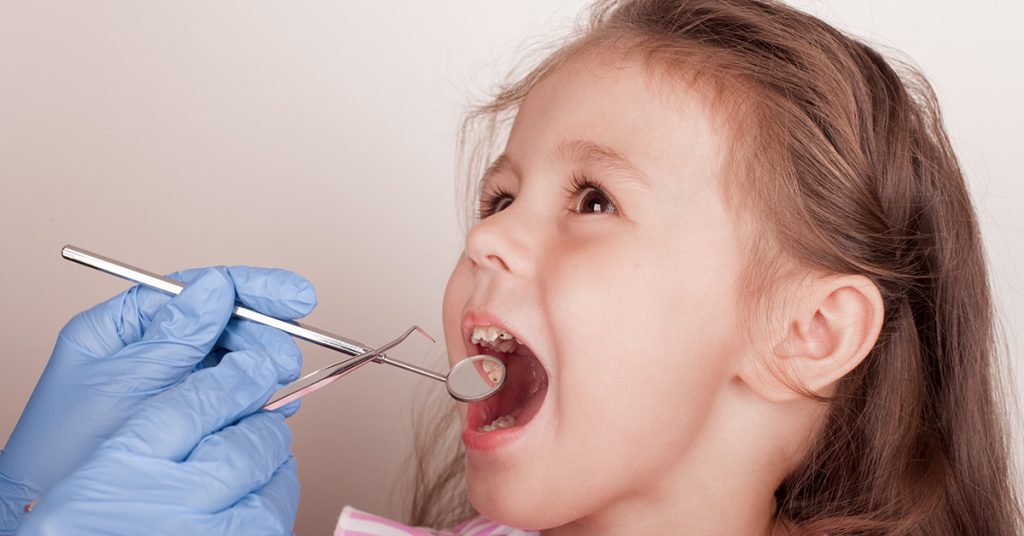 tips to prevent Tooth decay in kids