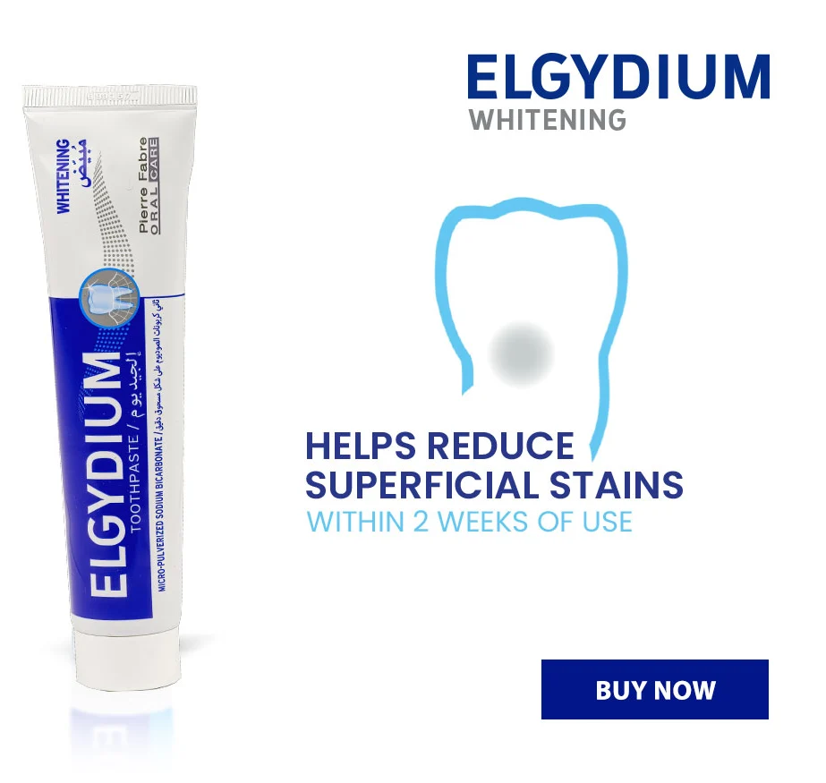 Best teeth whitening at home