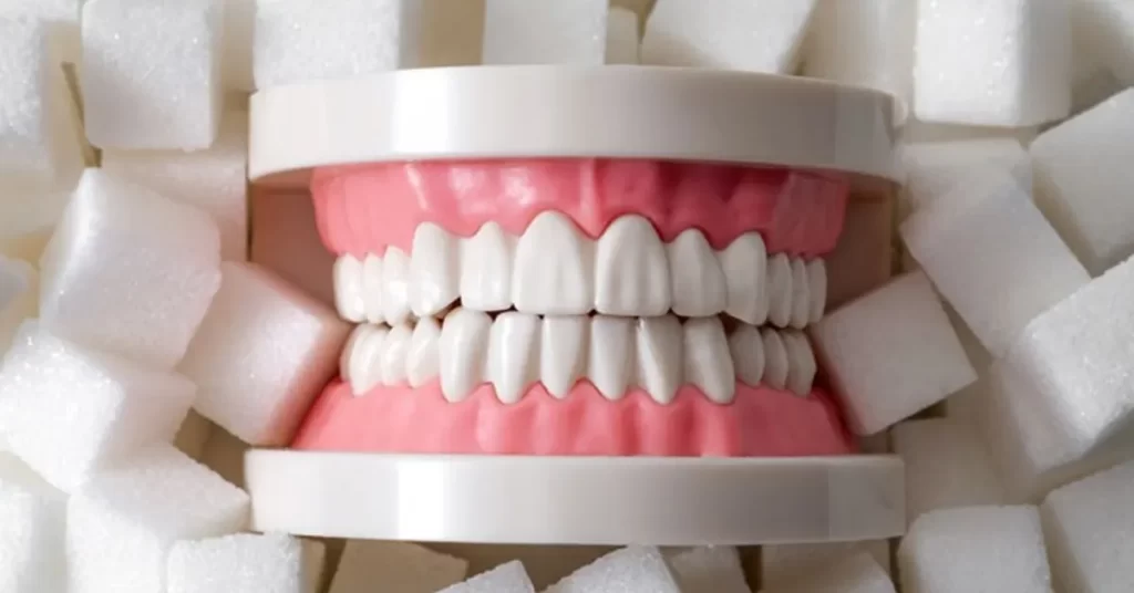 فهم تسوس الأسنان: تأثير السكر وكيفية الحفاظ على ابتسامة صحية
